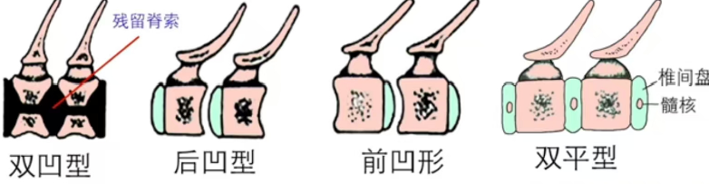 image-20250620110042580